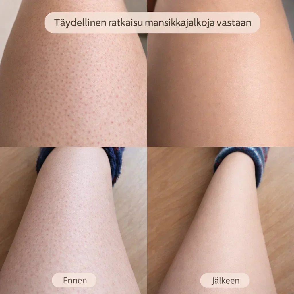 SilvaTrim – 2-in-1 karvanpoistaja sileään ihoon