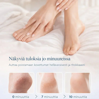 JalkaHoito – Sähköinen kovettumien poistaja jaloille