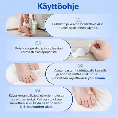KynsiHoito – Tehokas hoito kynsisientä vastaan
